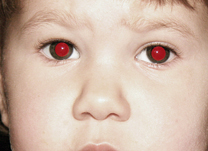Você sabe por que nossos olhos ficam vermelhos nas fotos?